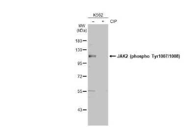 Western Blot: Jak2 [p Tyr1007, p Tyr1008] Antibody [NBP3-13138]